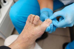 Podiatry Assessment Wahroonga